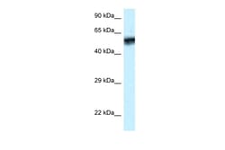 Aviva Systems Biology Corp CAMK4 Antibody - N-terminal region (ARP61351_P050)