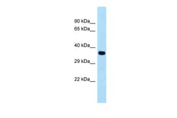 Aviva Systems Biology Corp CYSLTR1 Antibody - C-terminal region (ARP61366_P050)