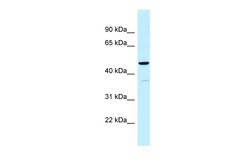 Aviva Systems Biology Corp UQCRC1 Antibody - N-terminal region (ARP61378_P050)