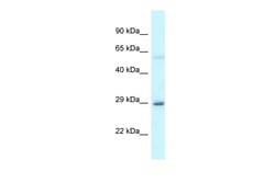 Aviva Systems Biology Corp EIF6 Antibody - C-terminal region (ARP61387_P050)