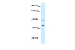 Aviva Systems Biology Corp TNFRSF14 Antibody - middle region (ARP61400_P050)