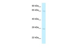 Aviva Systems Biology Corp MUS81 Antibody - C-terminal region (ARP61405_P050)