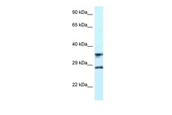 Aviva Systems Biology Corp RPS6 Antibody - C-terminal region (ARP61409_P050)