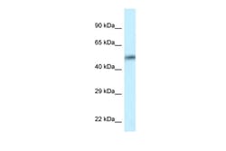 Aviva Systems Biology Corp CAMK2D Antibody - C-terminal region (ARP61459_P050)