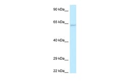 Aviva Systems Biology Corp LGI1 Antibody - N-terminal region (ARP61478_P050)