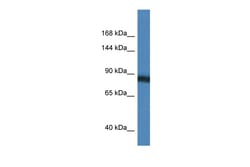 Aviva Systems Biology Corp SEMA4D Antibody - N-terminal region (ARP61493_P050)