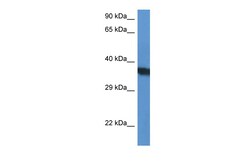 Aviva Systems Biology Corp SURF1 Antibody - N-terminal region (ARP61537_P050)