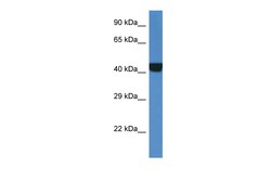 Aviva Systems Biology Corp PRKAR2A Antibody - middle region (ARP61563_P050)