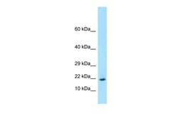 Aviva Systems Biology Corp Rpl26 Antibody - middle region (ARP61600_P050)