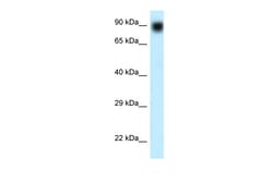 Aviva Systems Biology Corp NVL Antibody - N-terminal region (ARP61610_P050)