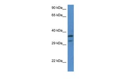 Aviva Systems Biology Corp RPL7 Antibody - C-terminal region (ARP61615_P050)