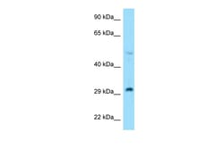 Aviva Systems Biology Corp RPL7 Antibody - N-terminal region (ARP61616_P050)