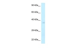 Aviva Systems Biology Corp NHEJ1 Antibody - C-terminal region (ARP61619_P050)
