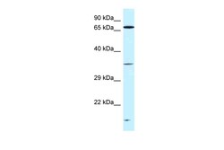 Aviva Systems Biology Corp VPS26A Antibody - C-terminal region (ARP61669_P050)