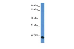 Aviva Systems Biology Corp COMMD1 Antibody - C-terminal region (ARP61706_P050)