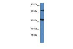 Aviva Systems Biology Corp TNIP1 Antibody - C-terminal region (ARP61714_P050)