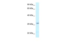 Aviva Systems Biology Corp VTI1B Antibody - C-terminal region (ARP61763_P050)