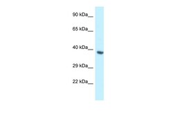 Aviva Systems Biology Corp BCL2L12 Antibody - middle region (ARP61767_P050)
