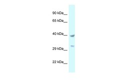 Aviva Systems Biology Corp STOML2 Antibody - C-terminal region (ARP61799_P050)