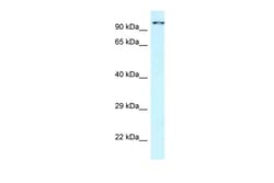 Aviva Systems Biology Corp CDK11A Antibody - C-terminal region (ARP61814_P050)