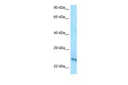 Aviva Systems Biology Corp Cmpk1 Antibody - C-terminal region (ARP61819_P050)
