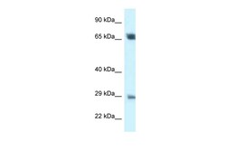 Aviva Systems Biology Corp SPC25 Antibody - middle region (ARP61828_P050)