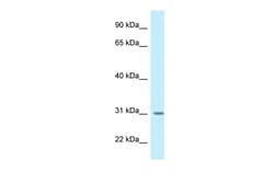 Aviva Systems Biology Corp BPHL Antibody - N-terminal region (ARP61857_P050)