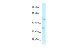 Aviva Systems Biology Corp PFKFB1 Antibody - C-terminal region (ARP61878_P050)