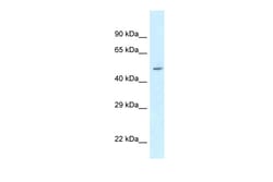 Aviva Systems Biology Corp ATXN10 Antibody - N-terminal region (ARP61891_P050)