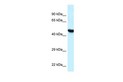 Aviva Systems Biology Corp HYAL3 Antibody - C-terminal region (ARP61904_P050)