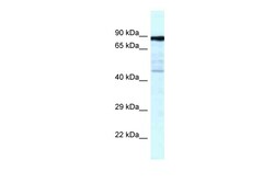 Aviva Systems Biology Corp CKAP2 Antibody - C-terminal region (ARP61929_P050)
