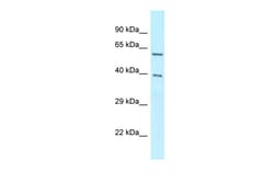 Aviva Systems Biology Corp BAG4 Antibody - C-terminal region (ARP61939_P050)