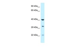 Aviva Systems Biology Corp GALK1 Antibody - C-terminal region (ARP61943_P050)