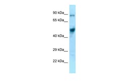 Aviva Systems Biology Corp Eif4a1 Antibody - C-terminal region (ARP61945_P050)
