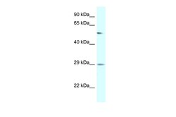 Aviva Systems Biology Corp AMY2B Antibody - N-terminal region (ARP61946_P050)