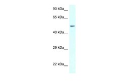 Aviva Systems Biology Corp AMY2B Antibody - C-terminal region (ARP61947_P050)