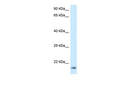 Aviva Systems Biology Corp RPL23A Antibody - C-terminal region (ARP61966_P050)