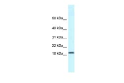 Aviva Systems Biology Corp SSBP1 Antibody - N-terminal region (ARP61972_P050)