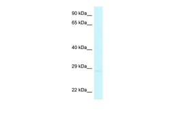 Aviva Systems Biology Corp CHMP4A Antibody - C-terminal region (ARP61976_P050)
