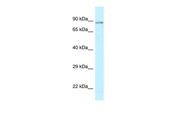 Aviva Systems Biology Corp SCYL1 Antibody - C-terminal region (ARP61984_P050)