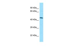 Aviva Systems Biology Corp DUSP9 Antibody - C-terminal region (ARP61992_P050)