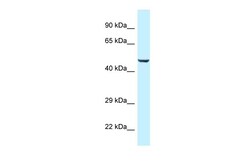 Aviva Systems Biology Corp TRMO Antibody - middle region (ARP62000_P050)