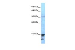 Aviva Systems Biology Corp KIF7 Antibody - C-terminal region (ARP62008_P050)