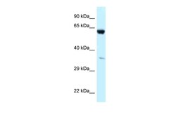 Aviva Systems Biology Corp P4HA1 Antibody - middle region (ARP62016_P050)