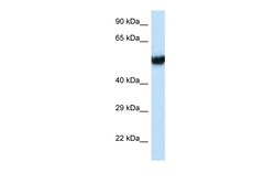 Aviva Systems Biology Corp IFT74 Antibody - C-terminal region (ARP62026_P050)