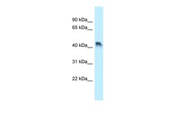 Aviva Systems Biology Corp ENTPD5 Antibody - N-terminal region (ARP62029_P050)
