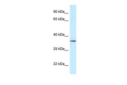 Aviva Systems Biology Corp NUDT6 Antibody - middle region (ARP62064_P050)