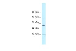 Aviva Systems Biology Corp RPL39 Antibody - N-terminal region (ARP62105_P050)