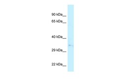 Aviva Systems Biology Corp CAPZA2 Antibody - N-terminal region (ARP62108_P050)