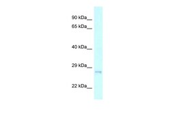 Aviva Systems Biology Corp CHMP2A Antibody - C-terminal region (ARP62112_P050)
